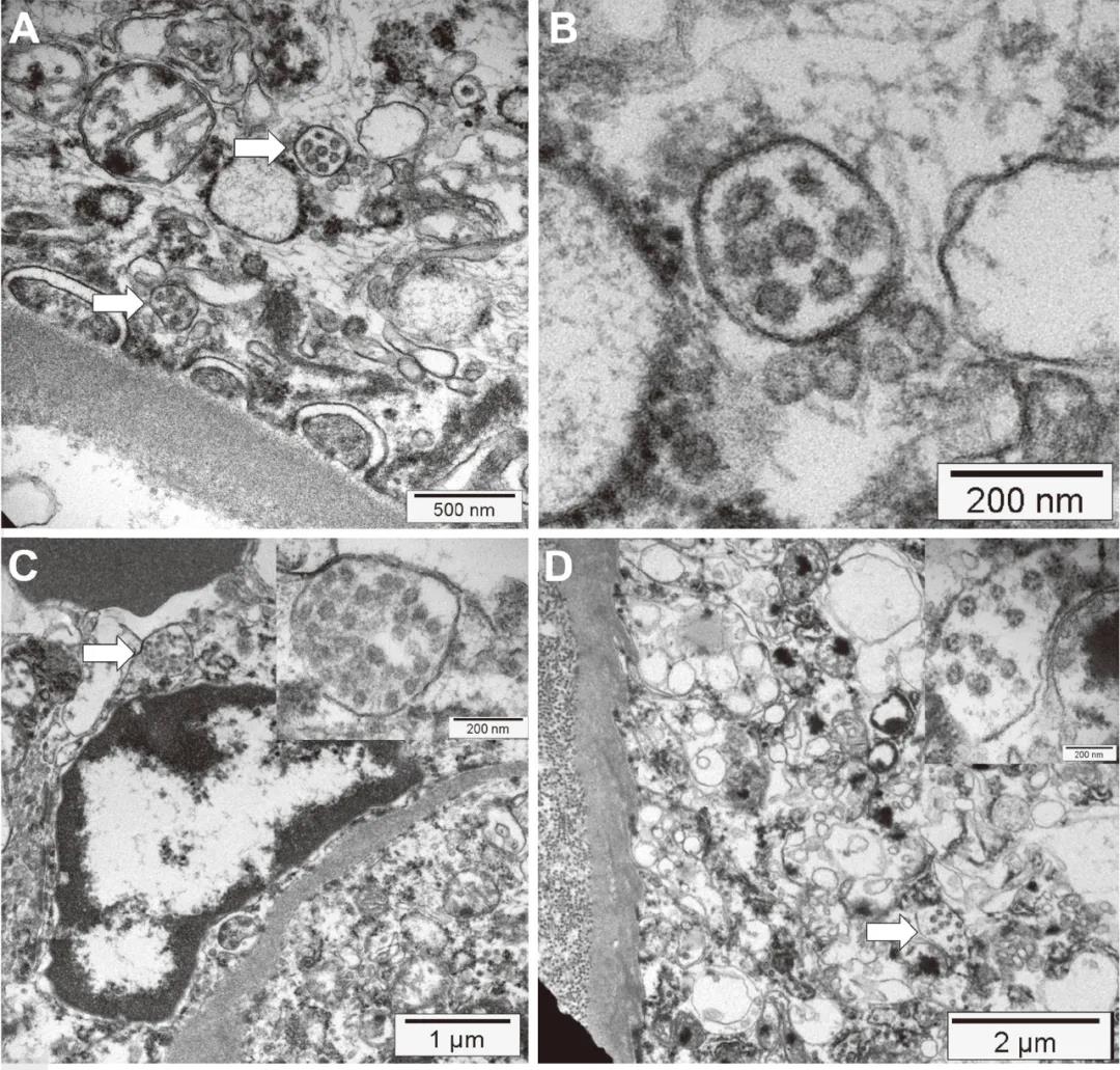 圖4:電鏡發(fā)現(xiàn) 圖4:電鏡發(fā)現(xiàn)